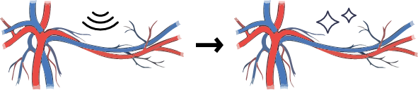 Folixレーザーの仕組み02